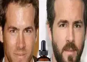 Top Benefits of Using Beard Essential Oil for Softer, Healthier Facial Hair